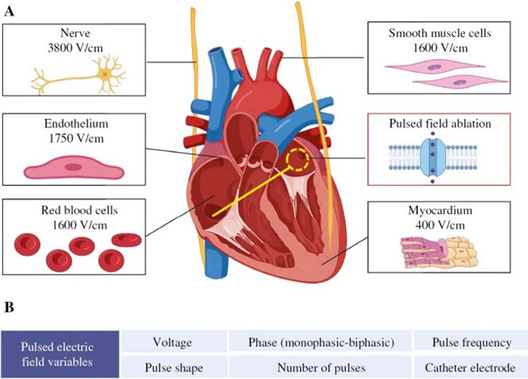 パルスフィールド