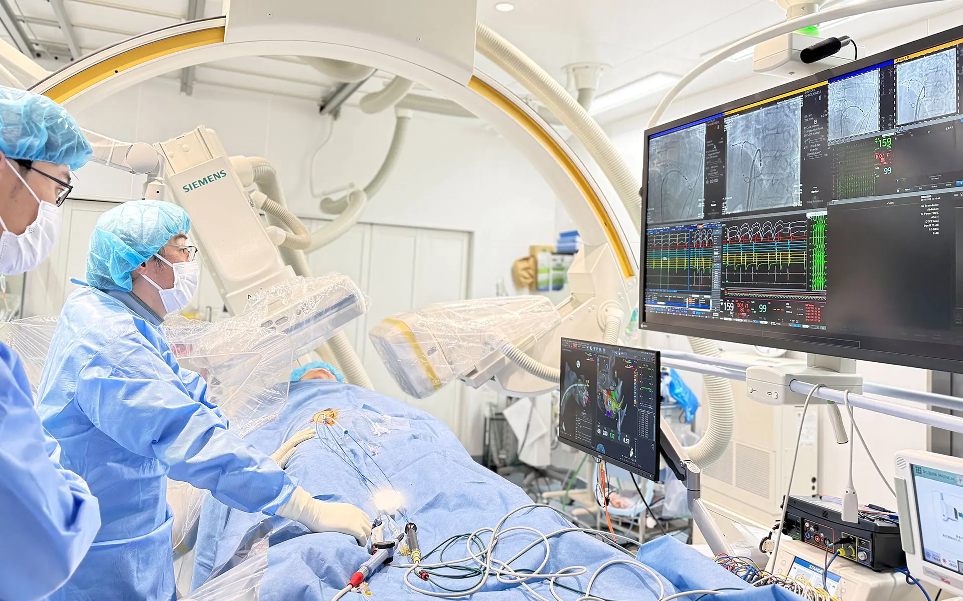 カテーテルアブレーション心筋焼却術（ABL）